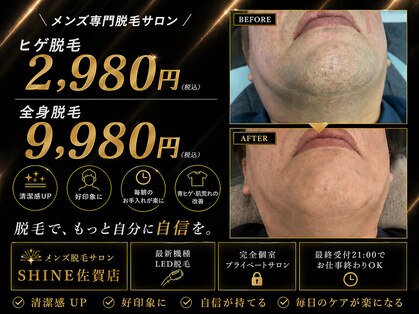 シャイン 佐賀店(SHINE)の写真