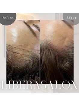 リベラサロン(LIBERA SALON)/コンプレックスのヘアラインも!