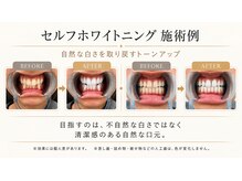 ハクア(HAKUA)の雰囲気（自信を持った白い歯へ）