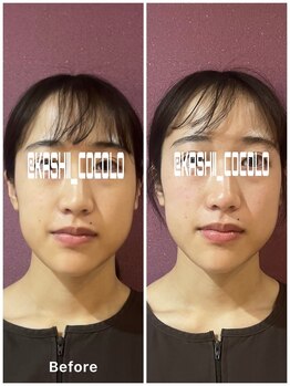 ココロ(CoCoLo)/ビフォーアフター