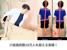 鍼灸接骨慈康院/4.総施術数10万人を超える実績