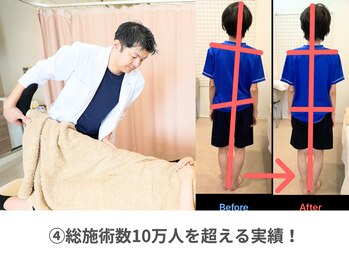 鍼灸接骨慈康院/4.総施術数10万人を超える実績