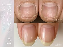 グレース(grace)/深爪卒業◎美爪育成コース