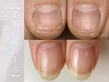 グレース(grace)/深爪卒業◎美爪育成コース