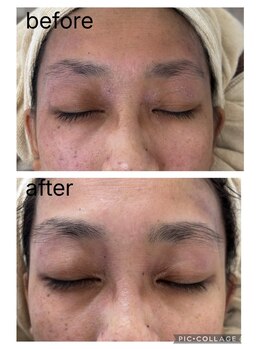 ルポ(Repos)/レディースエステシェービング