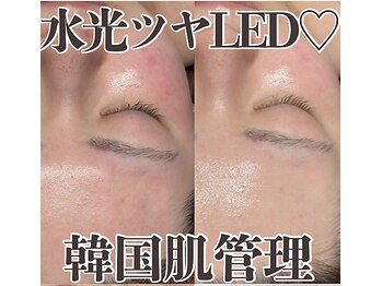 ミタメ 銀座店(MITAME)の写真/【水光ツヤ肌★】LED肌管理×ハーブで素肌毛穴・くすみ同時に撃退！◎20代30代向け。通い定額で定番人気！