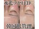 ミタメ 銀座店(MITAME)の写真/【水光ツヤ肌★】LED肌管理×ハーブで素肌毛穴・くすみ同時に撃退！◎20代30代向け。通い定額で定番人気！