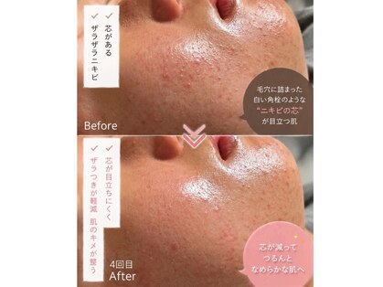 エステ リラクゼーションサロン(more)の写真