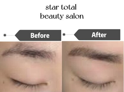 スター(Star)の写真