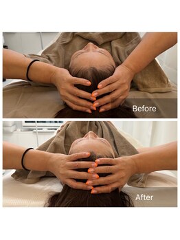 ステラルーテ(Stella lute)/【脳洗浄1回】頭の浮腫スッキリ!