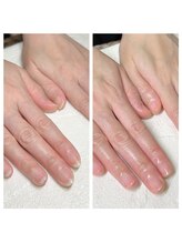 ユー(you)/ハンドケア