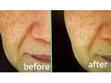 ファイブエレガンテ(5Elegante)/