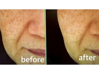 ファイブエレガンテ(5Elegante)/