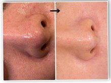 エフェクト 塚口店(effect)/Before After