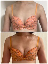 カナエルサロン 旭川(KANAERU SALON)/【バストアップ】症例☆