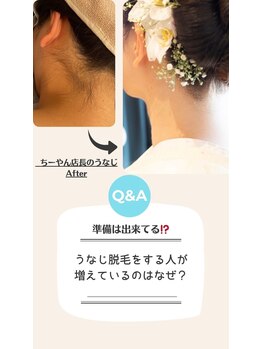 サロンアメリ 御座店(Salon Ameri)/高知　全身脱毛　サロンアメリ