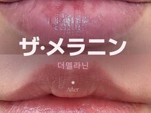 リア(Li'a.)の雰囲気（話題沸騰中のメラニンケア☆効果抜群のザメラニン使用◎）