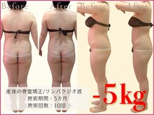 ココア整体 岐阜店(cocoa整体)/最新痩身マシン/脂肪燃焼リンパ