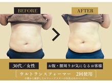 キレイ 筑紫野原田店(KIREI)/30代　お腹・腰周りが気になる