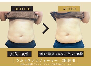 キレイ 筑紫野原田店(KIREI)/30代 お腹・腰周りが気になる