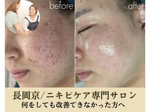 リノルーア(Linolua)