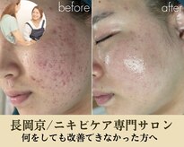 リノルーア(Linolua)