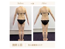 リスキン(Re:Skin)の雰囲気（気持ちよく寝てるだけで痩せる四国初の別人級オールハンド技術）