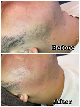 オム ボーテ(Homme Beaute)/フェイシャルワックス