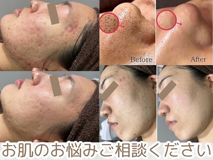 リモア(REMORE.)の写真