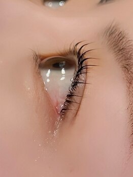 ルーフアイ(ROOF EYE)/ROOF EYE(ルーフ アイ)