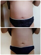 ロージーハピネス(Rosy happiness)/ぽってりしたお腹にも