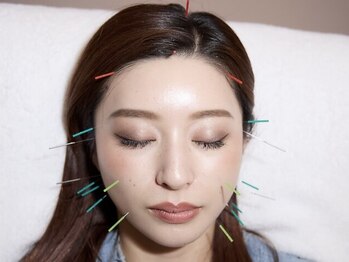 はりと美容鍼灸治療院(HaRi&美容鍼灸治療院)の写真/月1～2メンテで持続【リフトアップ小顔】食いしばり改善で顔の左右差も整う