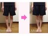 【O脚矯正】太もものハリ・脚の歪みが気になる方へ！¥8800→¥1980