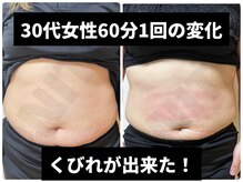 ヨサパーク ボニータ(YOSA PARK BONITA)