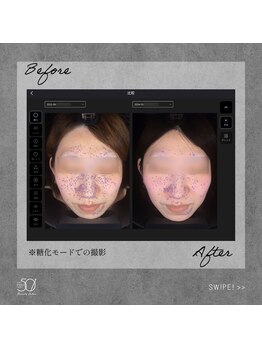 ゴーマルイチ(501)/