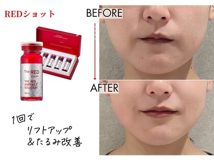 キレイベース 銀座店(KIREI BASE)の写真