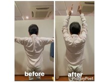 カワル整体 上通り院/挙上の構成要素とは。