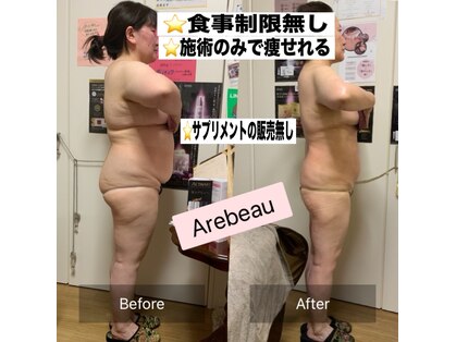 アレビュー(Arebeau)の写真