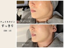 サロン ルイス アディクト(salon Lewis Addict)/ハイアールエフウェーブ