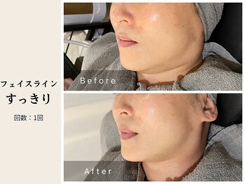 サロン ルイス アディクト(salon Lewis Addict)/ハイアールエフウェーブ