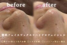 ホワイトラボ 堺東(White labo)