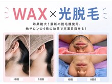 アルゴ 高槻店(ALGO)の雰囲気(【実力派サロン☆】結果重視で効果が早い!のお声多数◎)