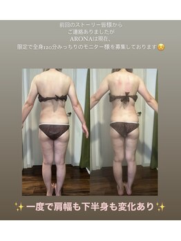 アローナ(ARONA)/後ろ姿美人になりませんか？