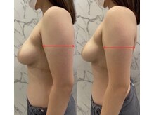 レナブルーム(Renabloom)/姿勢も美しく