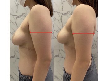 レナブルーム(Renabloom)/姿勢も美しく