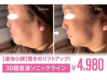 アネル 美里店(anel)の雰囲気（リフトアップお考えの方！まずは是非お試しください！）