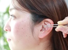 ジュピテール/耳ツボ施術