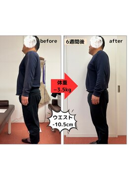 たかみや鍼灸接骨院/耳つぼ＋食事調整でダイエット