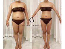 アンジール(Anjir)の雰囲気（運動なし！キチンと食べる話題のダイエットで-10キロ以上？！）
