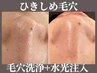 毛穴洗浄ハイドロフェイシャル(お鼻&Tゾーン)+針なし水光注入22000→¥9900
